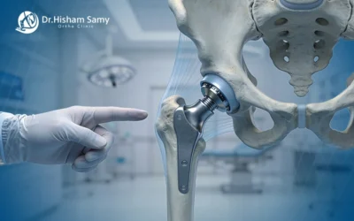 عملية تغيير مفصل الفخذ