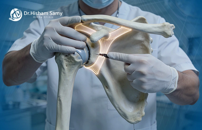 عملية قطع أوتار الكتف