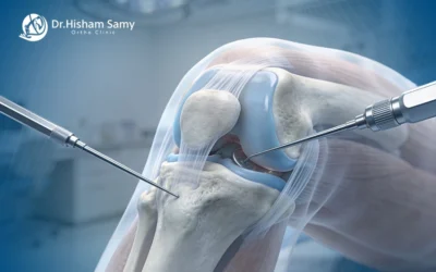 عملية منظار الركبة