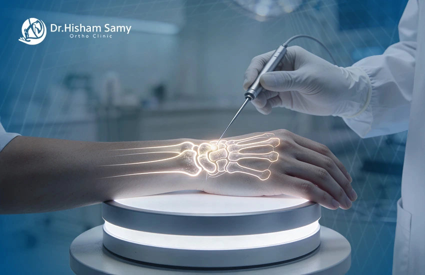 عملية منظار مفصل الرسغ