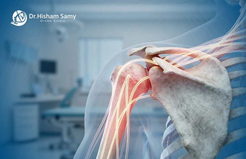 دليل شامل عن التهاب أوتار الكتف