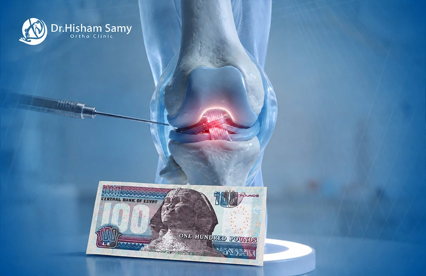 سعر عملية الرباط الصليبي: ما الذي يحدد الرقم النهائي؟
